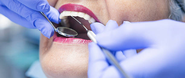 Best Emergency Root Canal Therapy in Plymouth, WI